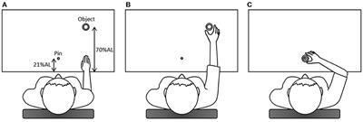 An Instrumental Measure of Hand and Facial Movement Abnormalities in Patients With Schizophrenia